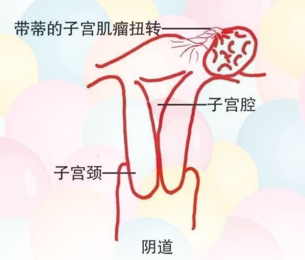 a01b77ab62308da03d46ef7e0899f4f.png