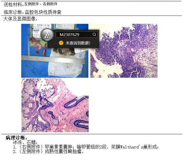 病理.jpg