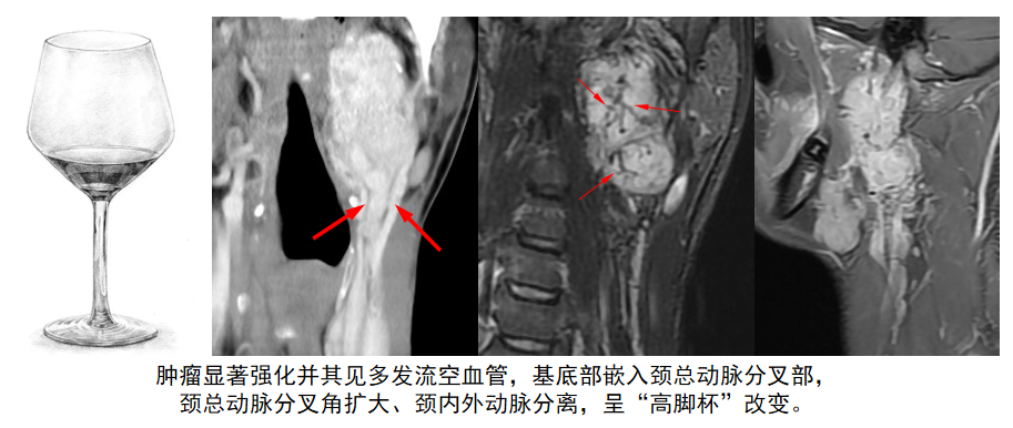 捕获.png