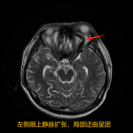 2153f53cf44d0590b6a9f20bb451d9e.png