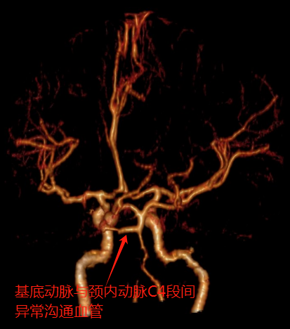 c478130145e9de60e6f2fc58f17e417.png