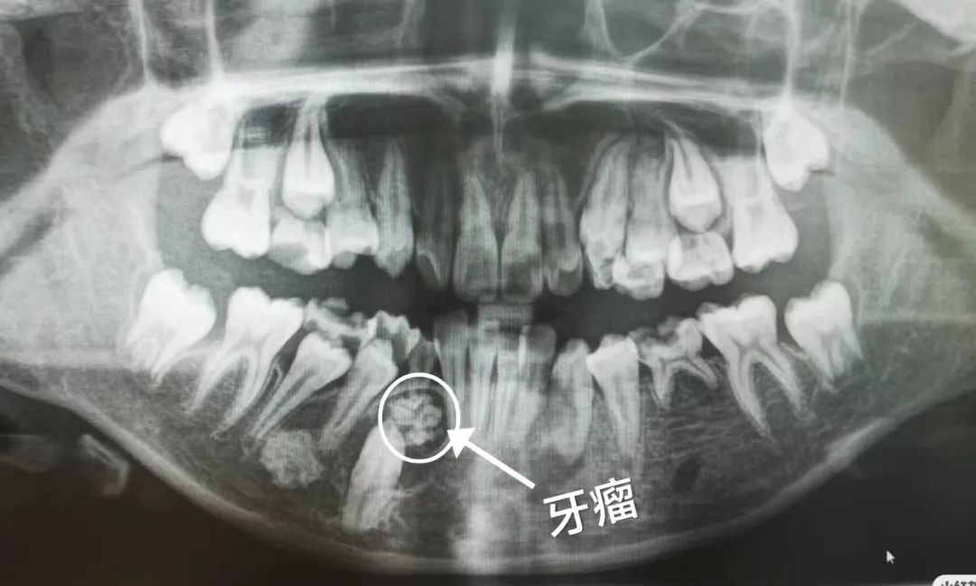 ba9453db91be51cf8935ae5f67dfaa79.jpg