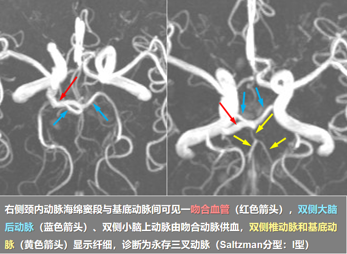 捕获.png