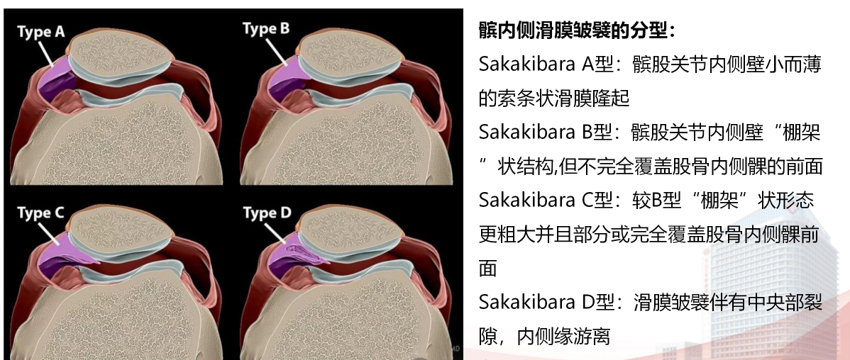 2429fb3ce661f27a81a8eeebf80d5f5.png