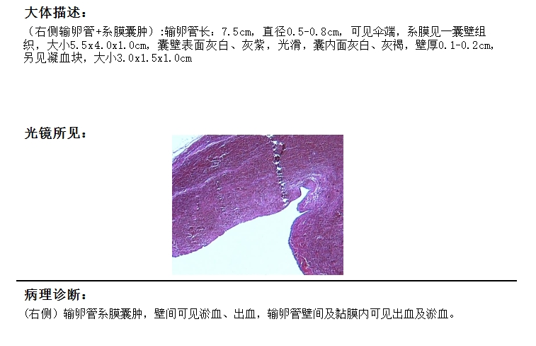 cf89d84a530dc93968a1dc7de9f4392.png