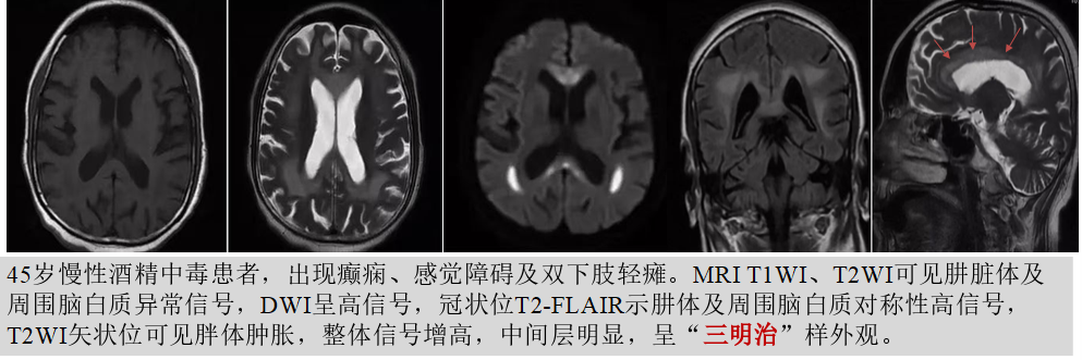 9507df0172f1bd07a6e930fccb15acf.png