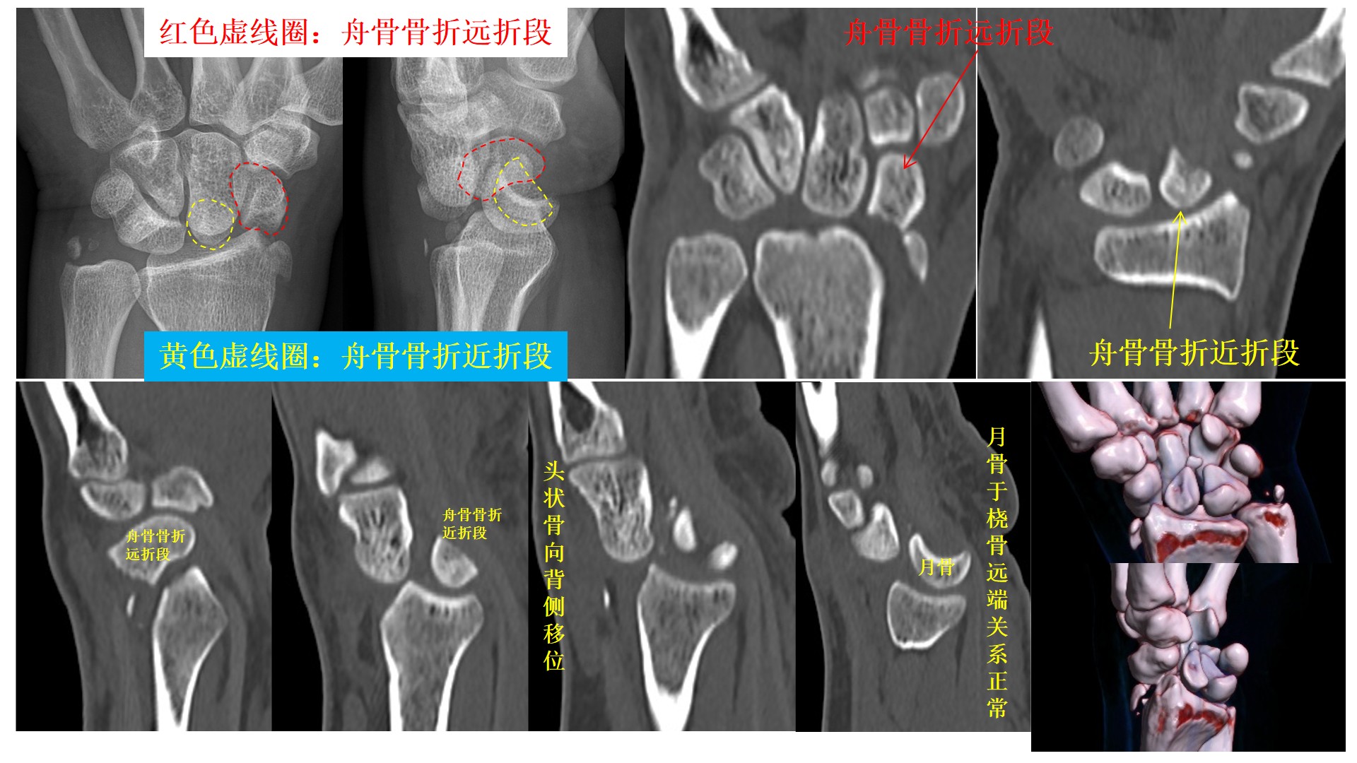 每例精解图片.jpg