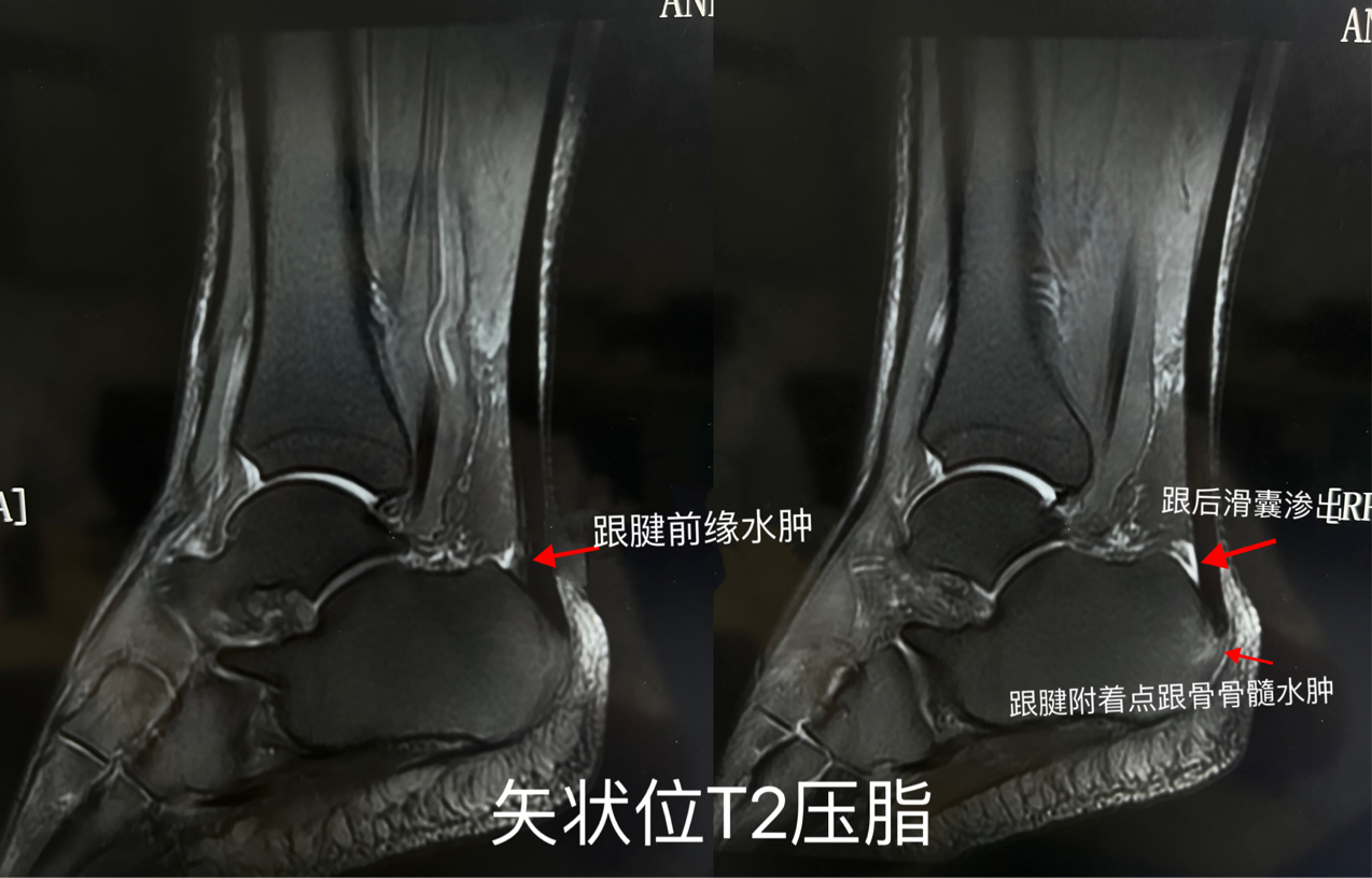 be23408094092b76facf7a486d76fde6.png
