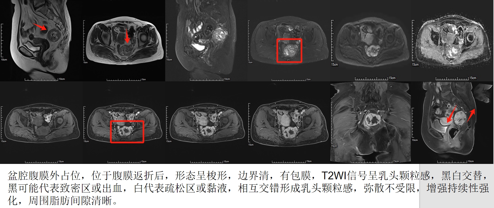 微信截图_20250413113710.png