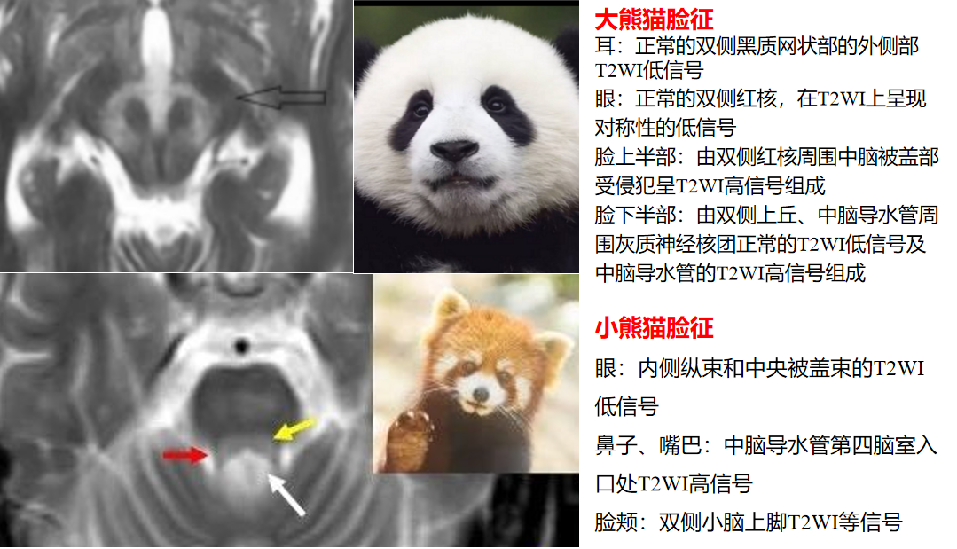 捕获.png