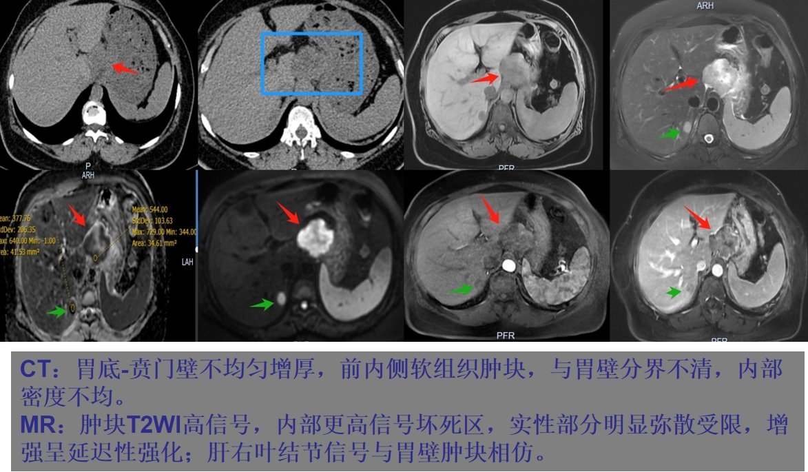 微信截图_20250504085335.png