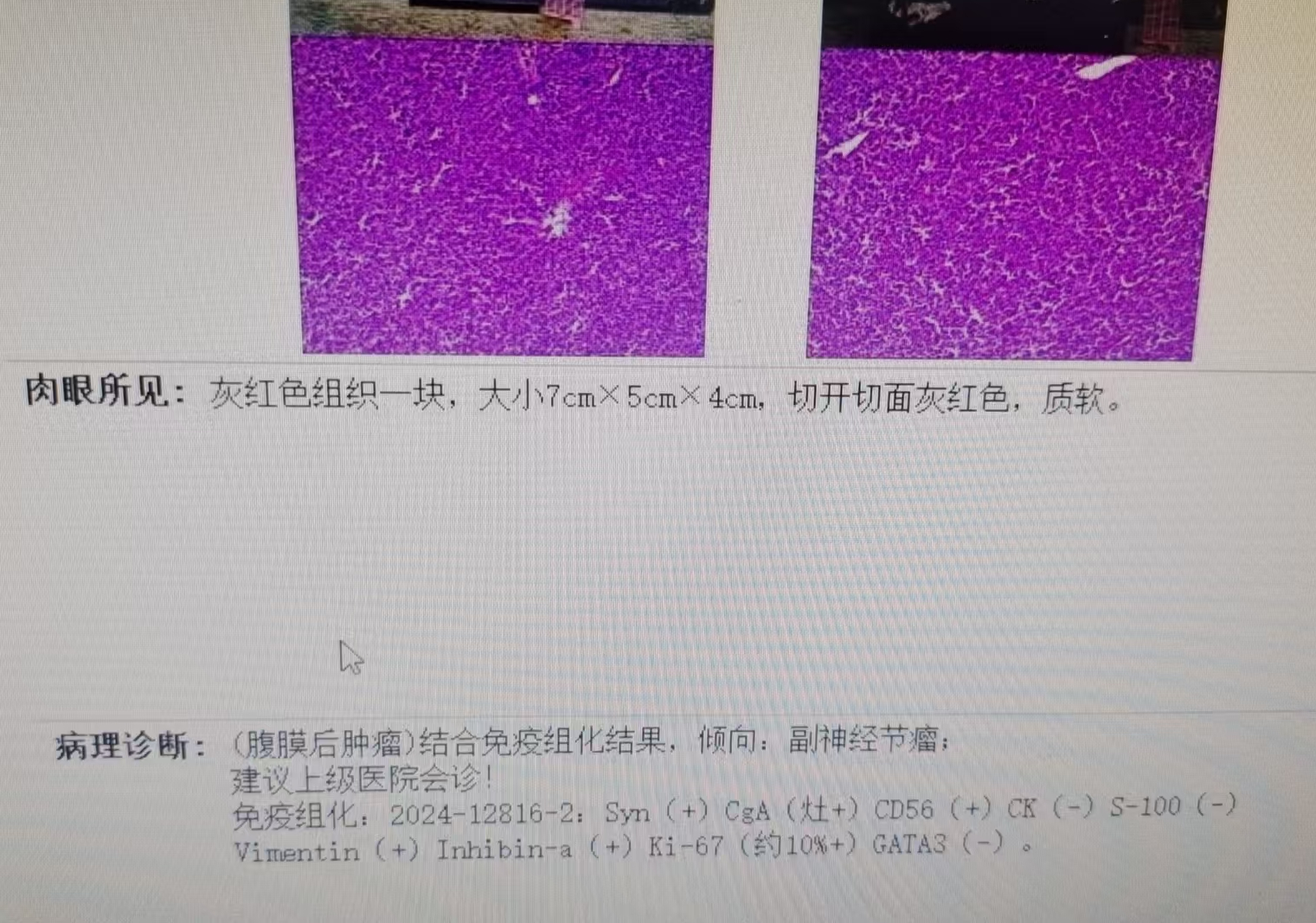 98224e13e4b28af580c4b548dbe2da5.png