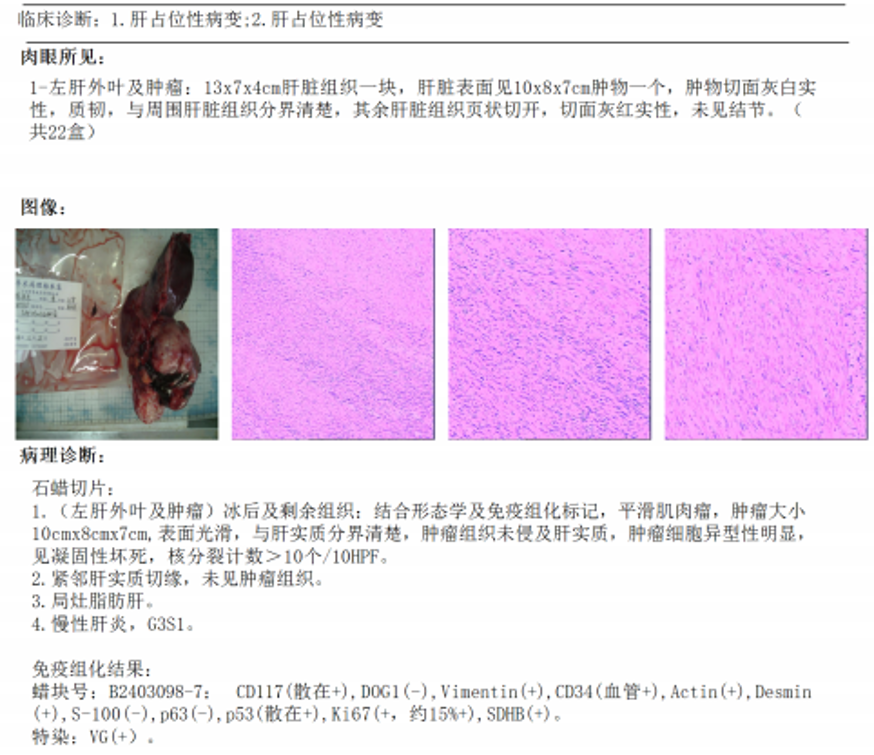 47e5db4b6c4ef06d211b23b91207919.png