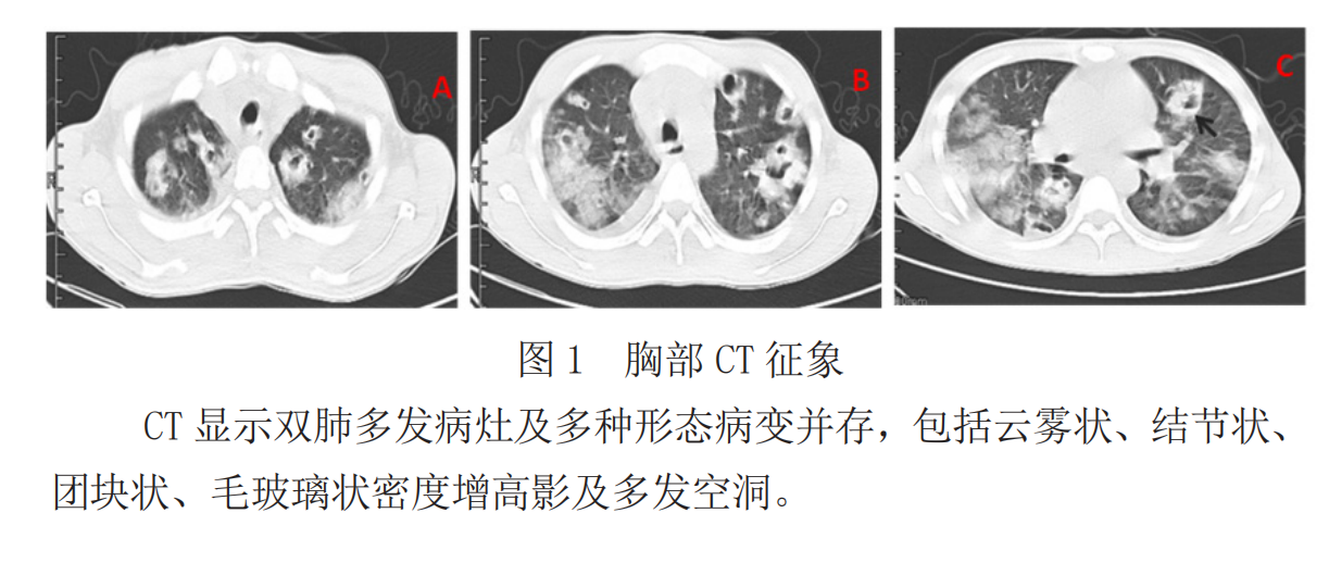 b30632a5c7417f0ae4d6683ce5f5afe.png
