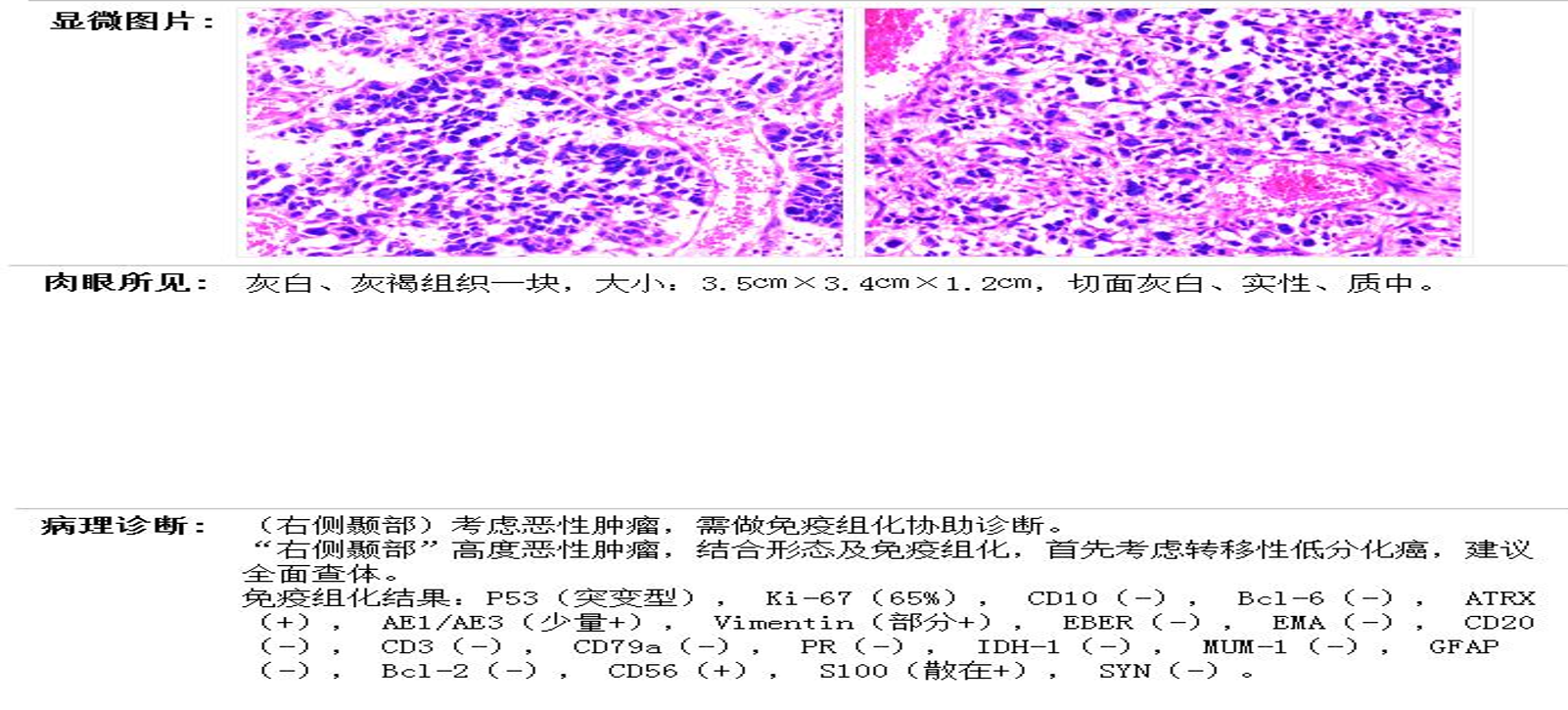 556193bd164de1780595f33abef56b4.png