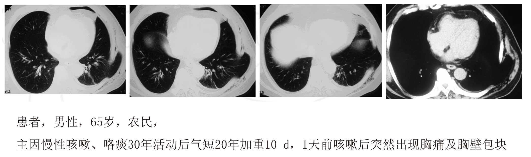 634e65d53a1b63eccf7c591eb173ce5.png