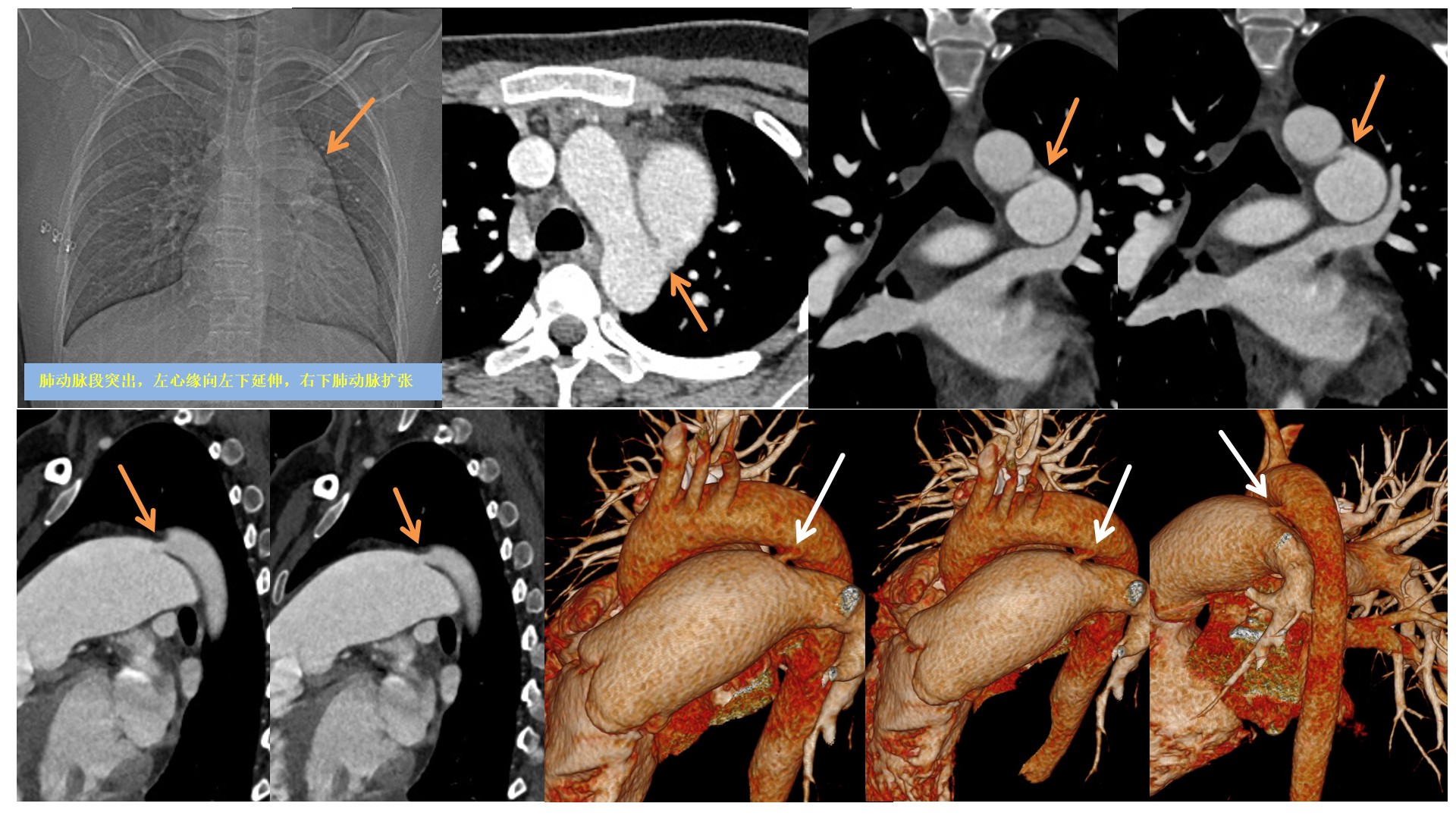 中国医学影像联盟-china medical imaging association