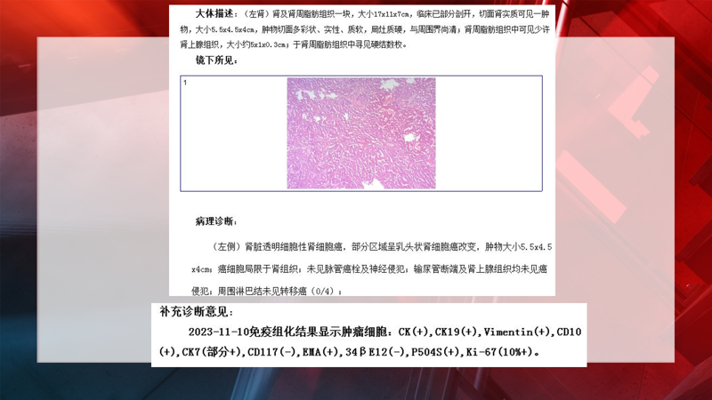 81179c7b-a546-47c0-ac89-2e7f61b4279c.png