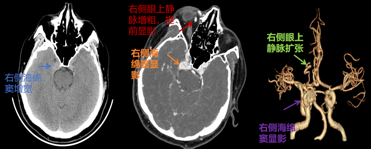 c4902e048eeec6800e6b0781ae270db4.png