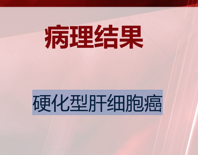 1949272d-c4d2-4411-b380-ab842fc7e3ec.png
