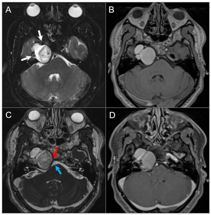 1789462088544094663.jpg tomography-09-00097-g018.jpg